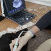 Ultrasound at home